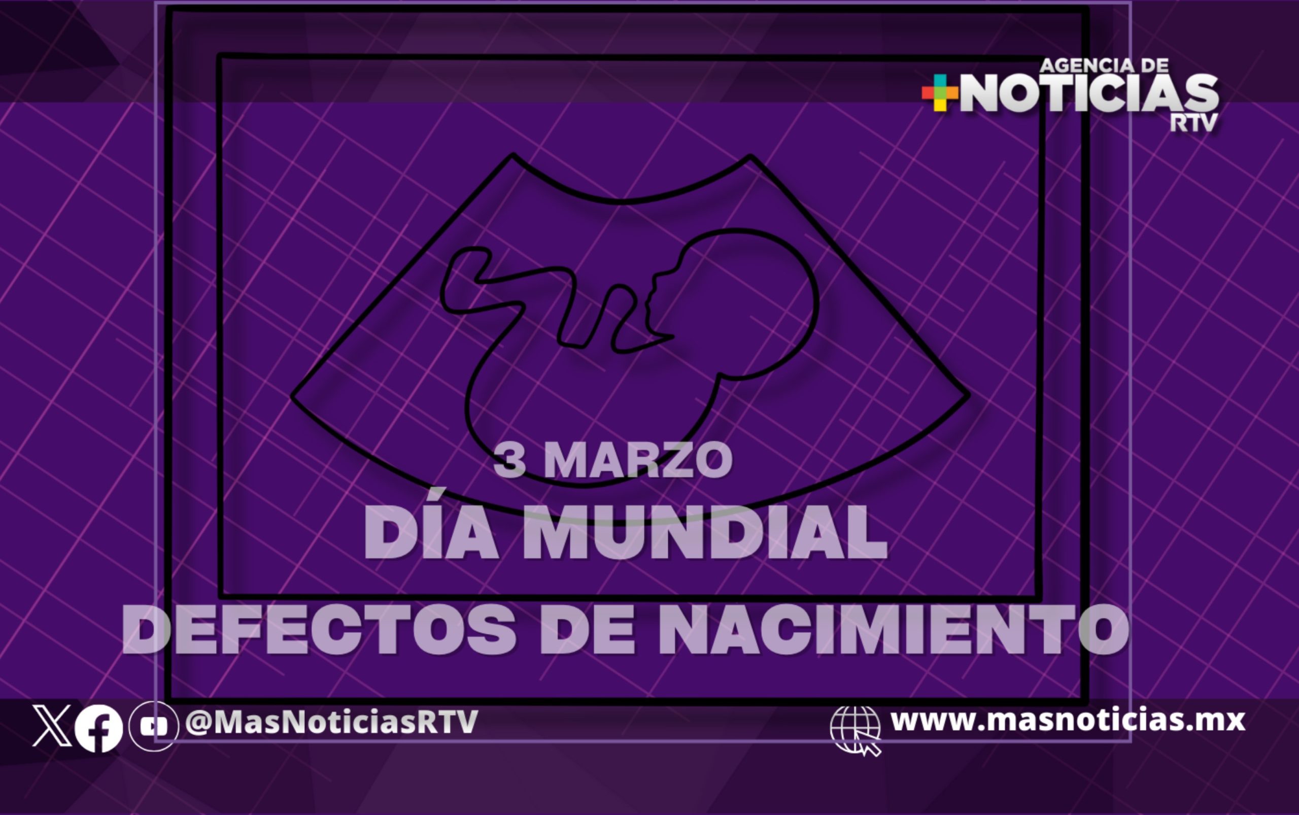 Día Mundial de los Defectos de Nacimiento