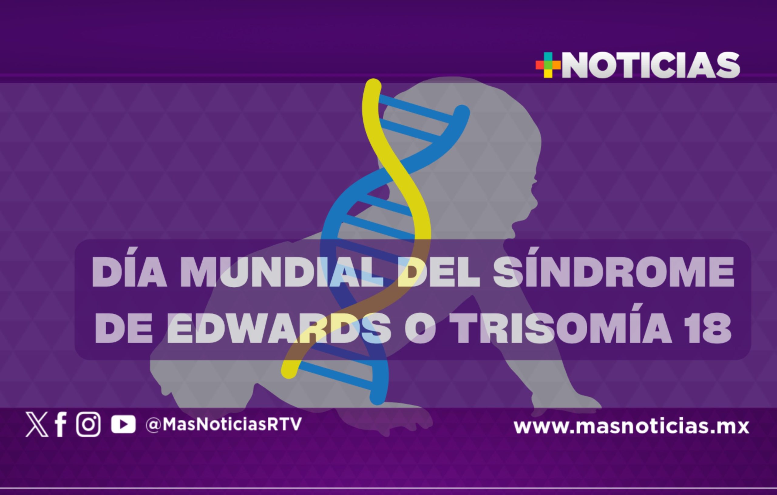 Día Mundial del Síndrome de Edwards o Trisomía 18