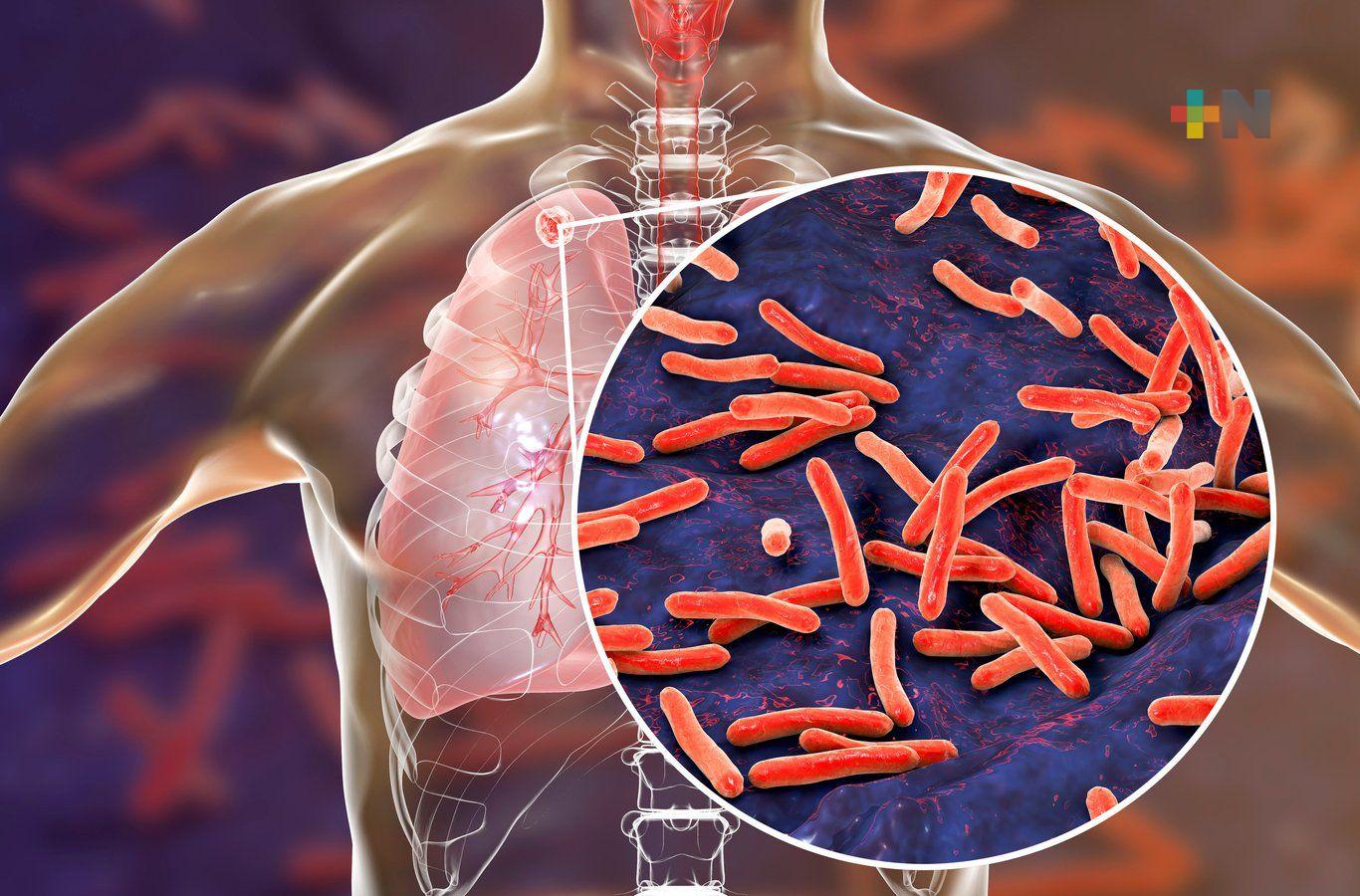 Tuberculosis, enfermedad que sigue presente y necesita atención temprana