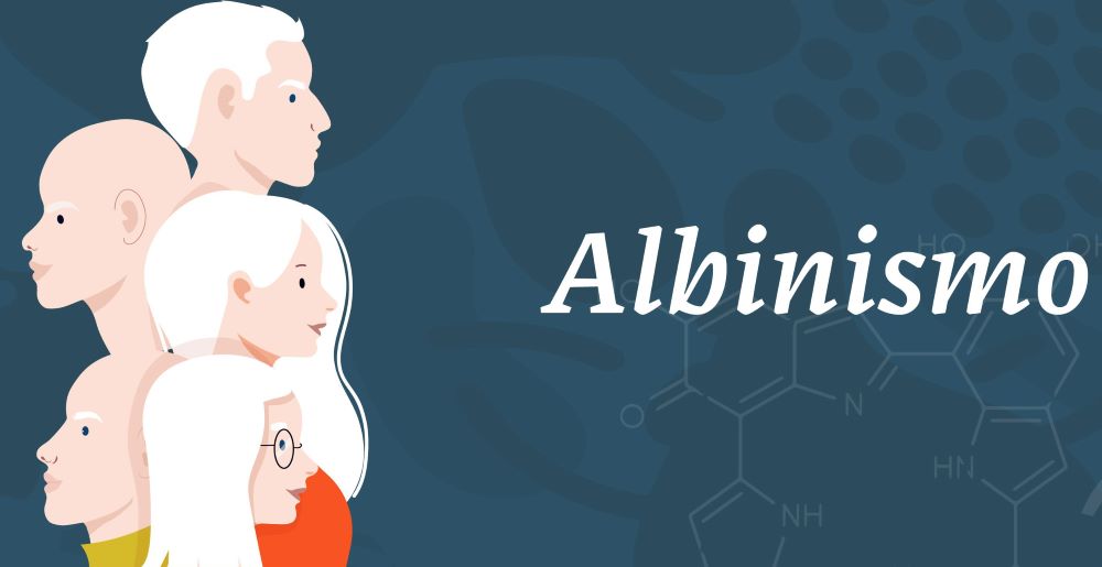 Día Internacional de Sensibilización sobre el Albinismo