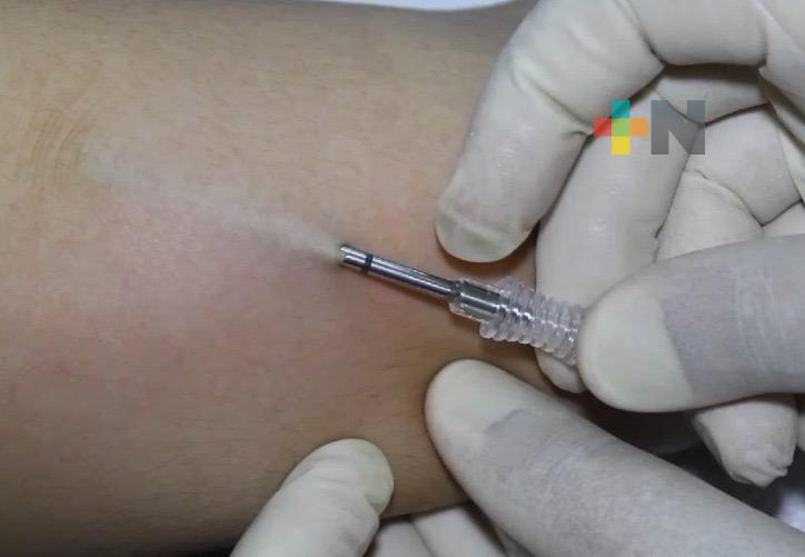 Implantes subdérmicos: opción segura y gratuita en jornada del IMSS Coatzacoalcos