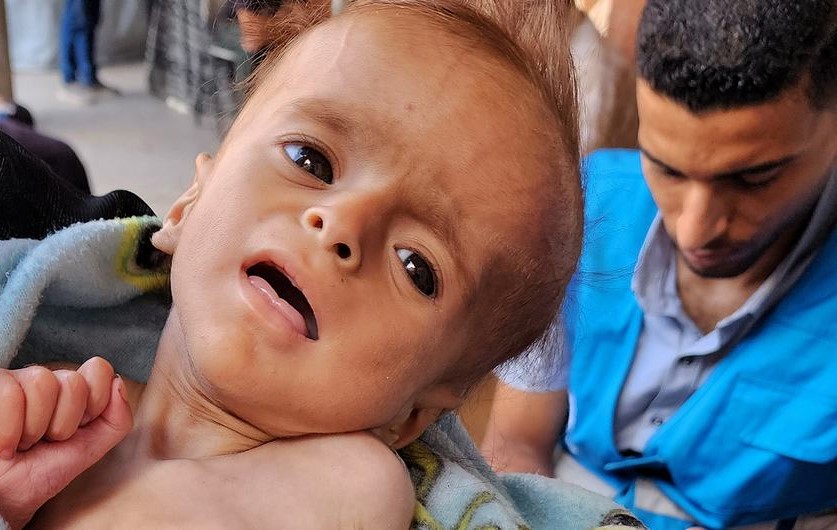 La OMS alerta sobre una «hambruna masiva» en Gaza