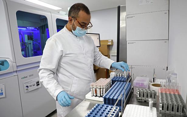 Para prevenir hepatitis, lavado de manos, higiene en preparación alimentos y uso de agua potable: IMSS