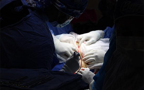 Retiran especialistas de IMSS Querétaro tumor ovárico de 22 kilos en paciente