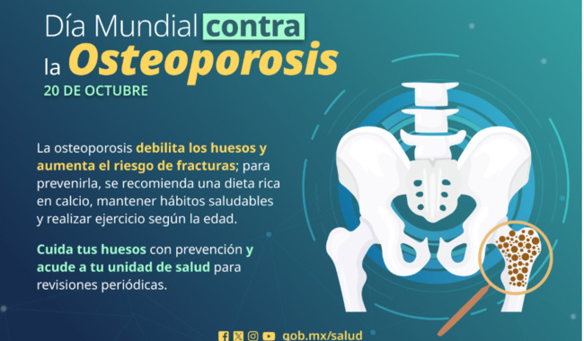 Secretaría de Salud prioriza acciones para prevenir y combatir la osteoporosis