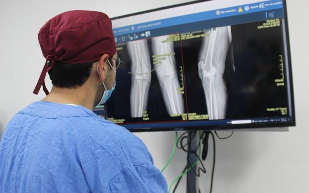 IMSS incorpora cirugía robótica para reemplazo de rodilla