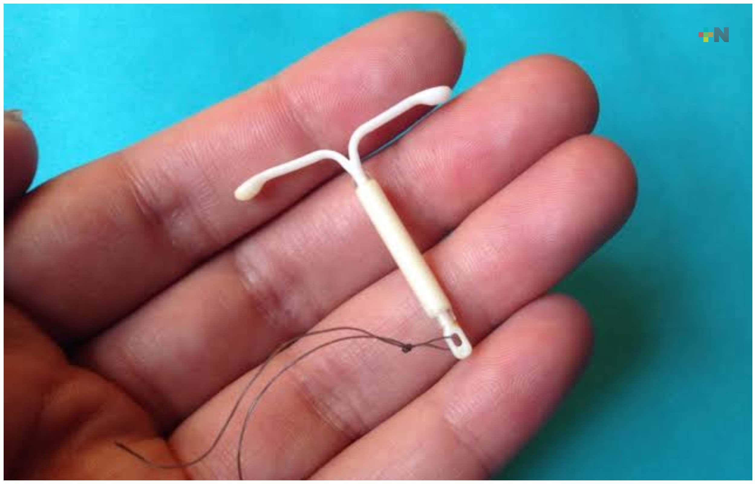 IMSS realizará jornada gratuita de implantes y DIU para jóvenes en Minatitlán