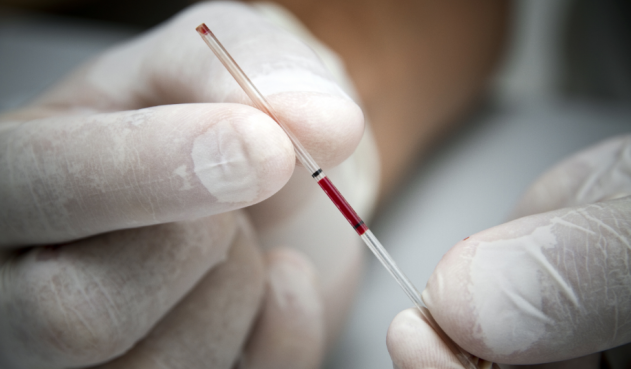 Científicos hallan un nuevo subtipo de VIH, sería el primero desde el año 2000