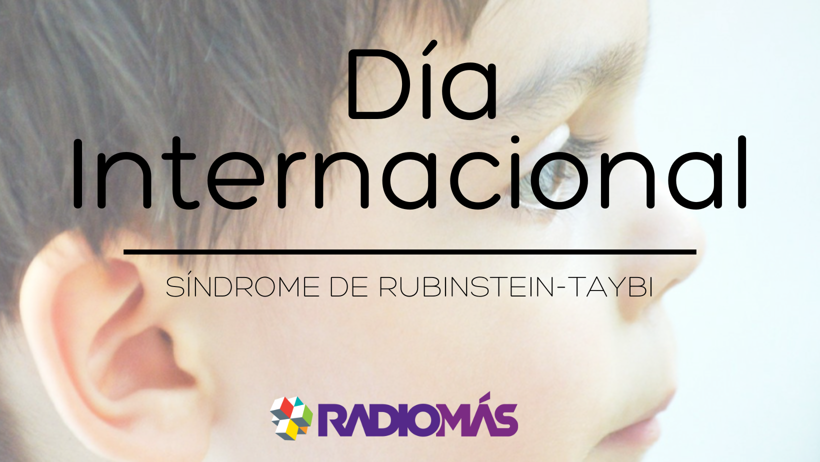 Conoce más acerca del Síndrome de Rubinstein-Taybi